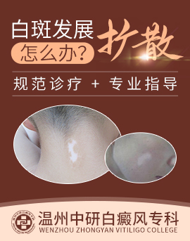溫州白癜風(fēng)醫(yī)院那家好